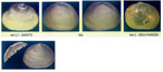 Lepton squamosus