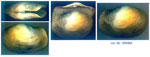 Panopea glycimeris